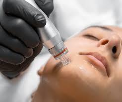 Acne Facial